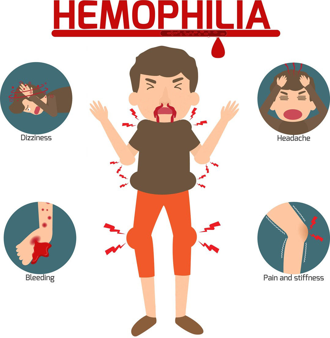Hemophilia A Figure 没有血斑.jpg